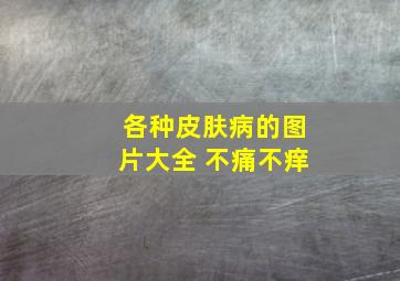 各种皮肤病的图片大全 不痛不痒